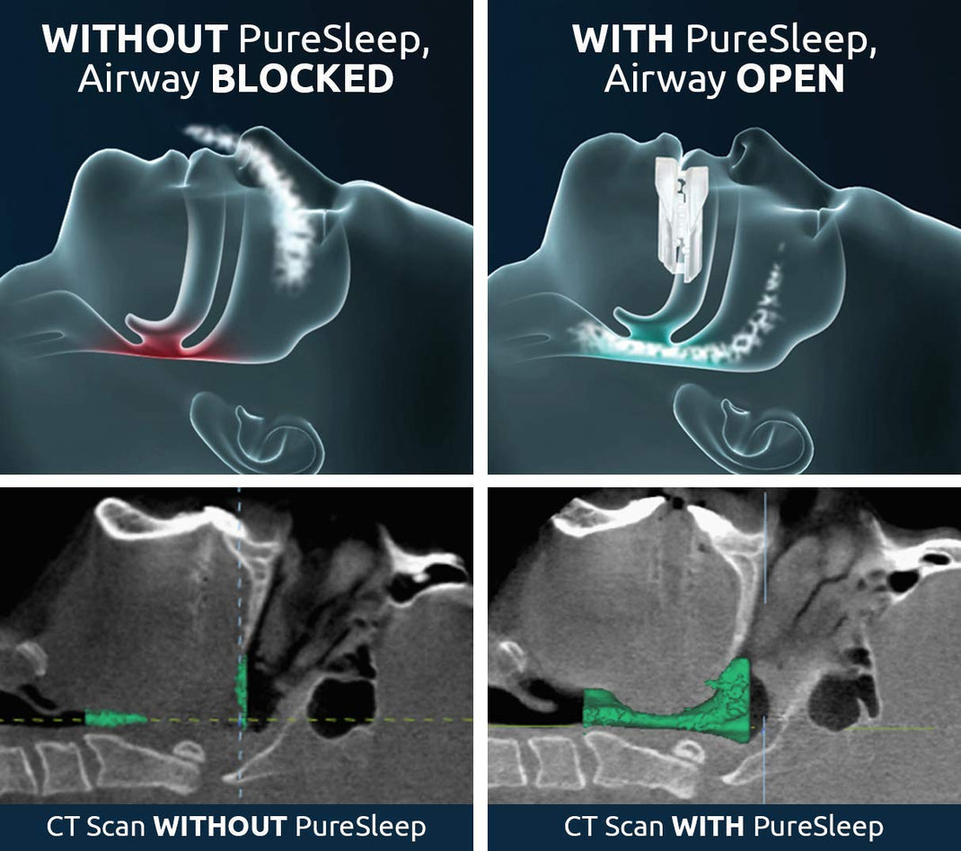 How it works – PureSleep